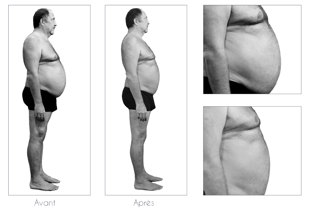 Résultats-Anne-Cali-perte-de-poids-moins-17kg-03-2