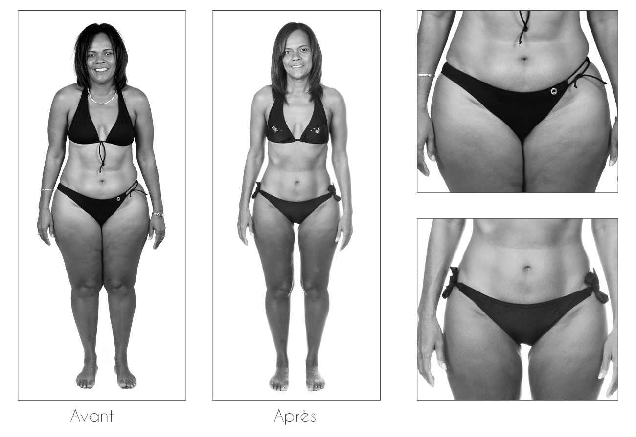 Résultats-Anne-Cali-perte-de-poids-moins-17kg-04-2
